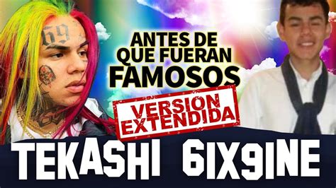 tekashi antes de tatuarse|UniMás 